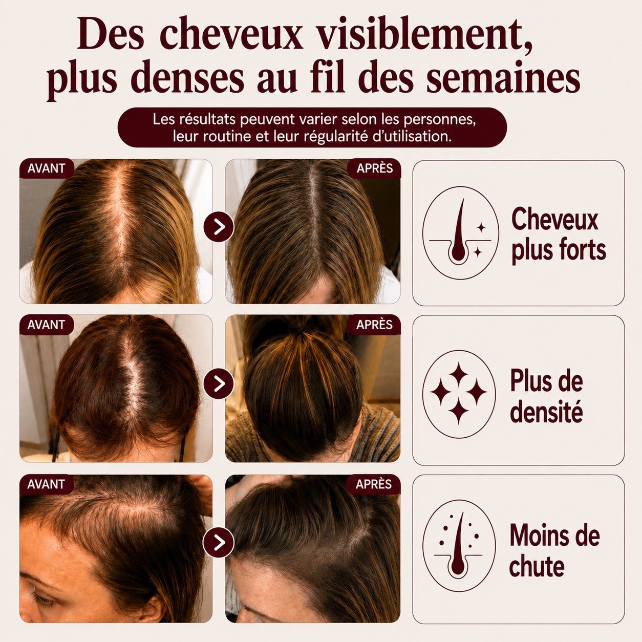 Ovis-moins de chute plus de confiance